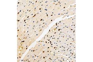 Immunohistochemistry (Paraffin-embedded Sections) (IHC (p)) image for anti-DEP Domain Containing 1 (DEPDC1) antibody (ABIN7073717)