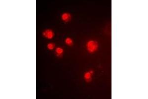 Immunofluorescent analysis of ALG-2 staining in Hela cells. (ALG2 抗体)