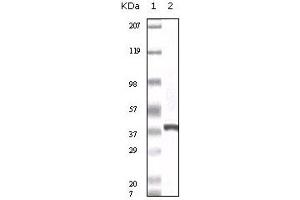 Western blot analysis using calcyclin mouse mAb against truncated calcyclin recombinant protein. (S100A6 抗体)