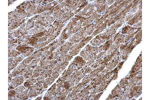 IHC-P Image NDUFV2 antibody detects NDUFV2 protein at mitochondria on mouse heart by immunohistochemical analysis. (NDUFV2 抗体  (Center))