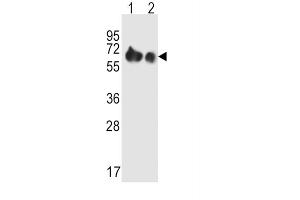 Western Blotting (WB) image for anti-Solute Carrier Family 3 (Activators of Dibasic and Neutral Amino Acid Transport), Member 2 (SLC3A2) antibody (ABIN2995541) (SLC3A2 抗体)