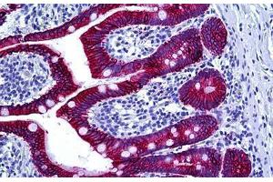 Human Intestine: Formalin-Fixed, Paraffin-Embedded (FFPE) (Keratin Basic 抗体)