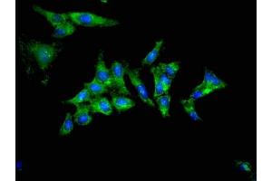 Immunofluorescent analysis of Hela cells using ABIN7173361 at dilution of 1:100 and Alexa Fluor 488-congugated AffiniPure Goat Anti-Rabbit IgG(H+L) (TRIB2 抗体  (AA 204-337))