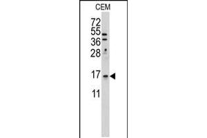 Western blot analysis of anti-LSM1 Antibody in Hela cell line lysates (35ug/lane) (LSM1 抗体  (C-Term))