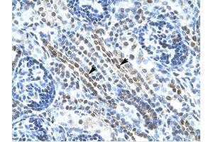 ANKRD11 antibody was used for immunohistochemistry at a concentration of 4-8 ug/ml to stain Epithelial cells of renal tubule (arrows) in Human Kidney. (ANKRD11 抗体  (N-Term))