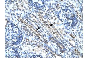 ANKRD11 antibody was used for immunohistochemistry at a concentration of 4-8 ug/ml to stain Epithelial cells of renal tubule (arrows) in Human Kidney.