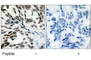 Image no. 1 for anti-Retinoblastoma 1 (RB1) (Ser780) antibody (ABIN197285) (Retinoblastoma 1 抗体  (Ser780))