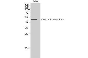 Western Blotting (WB) image for anti-Casein Kinase 1, gamma 2 (CSNK1G2) (N-Term) antibody (ABIN3183661) (Casein Kinase 1 gamma 2 抗体  (N-Term))