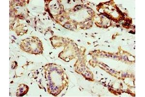 Immunohistochemistry (IHC) image for anti-Adaptor-Related Protein Complex 1, mu 2 Subunit (AP1m2) (AA 164-423) antibody (ABIN7144352)