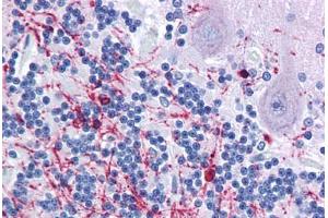 Human Brain, cerebellum: Formalin-Fixed, Paraffin-Embedded (FFPE) (Cnpase 抗体  (AA 122-352))