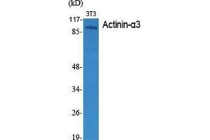Western Blot (WB) analysis of specific cells using Actinin-alpha3 Polyclonal Antibody. (ACTN3 抗体  (N-Term))