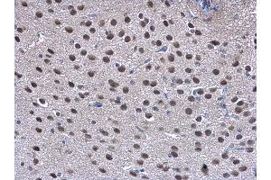 Immunohistochemistry (IHC) image for anti-COP9 Constitutive Photomorphogenic Homolog Subunit 2 (Arabidopsis) (COPS2) (C-Term) antibody (ABIN2856345)