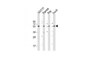 All lanes : Anti-FCRL4 Antibody (C-term) at 1:2000 dilution Lane 1: 293T/17 whole cell lysate Lane 2: Ramos whole cell lysate Lane 3: Raji whole cell lysate Lane 4: Daudi whole cell lysate Lysates/proteins at 20 μg per lane. (FCRL4 抗体  (C-Term))