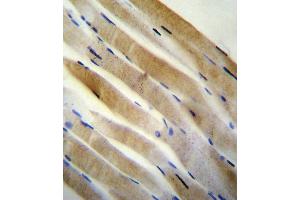 PRK (Thr172) antibody (Center) (ABIN654800 and ABIN2844475) immunohistochemistry analysis in formalin fixed and paraffin embedded human skeletal muscle followed by peroxidase conjugation of the secondary antibody and DAB staining. (PRKAA2 抗体  (Thr172))