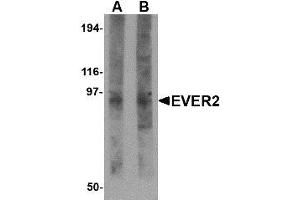 Image no. 1 for anti-Transmembrane Channel-Like 8 (TMC8) (N-Term) antibody (ABIN1494395) (TMC8 抗体  (N-Term))