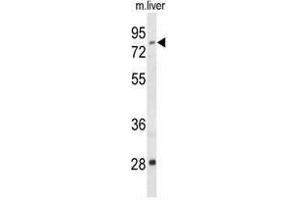 Western Blotting (WB) image for anti-Acyl-CoA Synthetase Short-Chain Family Member 2 (ACSS2) (AA 38-68), (N-Term) antibody (ABIN950257)