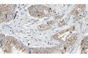 ABIN6278588 at 1/100 staining Human prostate tissue by IHC-P. (GAL4 抗体  (N-Term))