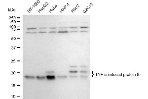 Western blotting analysis using TNF alpha induced protein 8 antibody (ABIN7800679). (Recombinant TNFAIP8 抗体)