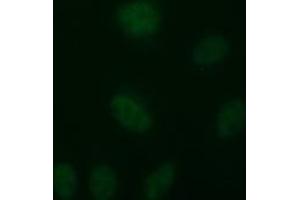 Image no. 2 for anti-Tubulin, beta 2B (TUBB2B) antibody (ABIN1501571) (TUBB2B 抗体)