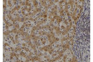 ABIN6273482 at 1/100 staining Human liver tissue by IHC-P. (MAP3K14 抗体  (C-Term))
