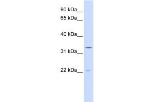 WB Suggested Anti-INMT Antibody Titration:  0.