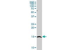 SH2D1A MaxPab rabbit polyclonal antibody. (SH2D1A 抗体  (AA 1-128))