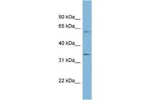 WB Suggested Anti-OSGEP Antibody Titration: 0. (OSGEP 抗体  (Middle Region))