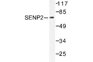 Image no. 1 for anti-SUMO1/sentrin/SMT3 Specific Peptidase 2 (SENP2) antibody (ABIN271956) (SENP2 抗体)