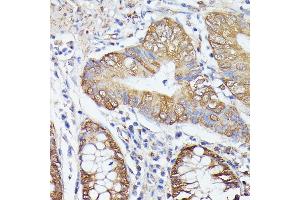 Immunohistochemistry (IHC) image for anti-Thyroid Hormone Receptor Interactor 4 (TRIP4) (AA 282-581) antibody (ABIN7270824)