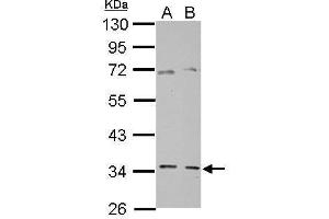 WB Image Sample (30 ug of whole cell lysate) A: PC-3 B: SK-N-SH 10% SDS PAGE antibody diluted at 1:10000 (GGPS1 抗体)