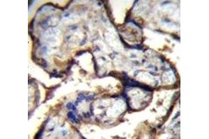 Immunohistochemistry (IHC) image for anti-Integrin, alpha 5 (ITGA5) (AA 575-602) antibody (ABIN3031396)