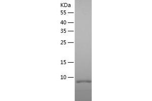 Western Blotting (WB) image for Tumor Necrosis Factor Receptor Superfamily, Member 17 (TNFRSF17) (AA 5-54) protein (His tag) (ABIN7125551)