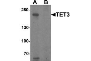 Western blot analysis of TET3 in SK-N-SH cell lysate with TET3 Antibody  at 1 μg/ml in (A) the absence and (B) the presence of blocking peptide (TET3 抗体  (C-Term))