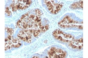 Formalin-fixed, paraffin-embedded human Colon stained with MUC1 Rabbit Recombinant Monoclonal Antibody (MUC1/2818R). (Recombinant MUC1 抗体)