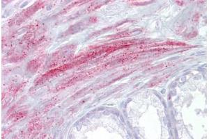 Immunohistochemistry (IHC) image for anti-Transient Receptor Potential Cation Channel, Subfamily M, Member 8 (TRPM8) (AA 251-300) antibody (ABIN959036)