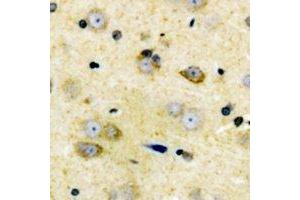 Immunohistochemical analysis of Cyclin D2 staining in human brain formalin fixed paraffin embedded tissue section. (Cyclin D2 抗体)