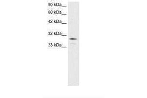Image no. 3 for anti-Orthodenticle Homeobox 2 (OTX2) (AA 86-135) antibody (ABIN6735803) (OTX2 抗体  (AA 86-135))