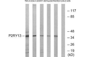 Western Blotting (WB) image for anti-Purinergic Receptor P2Y, G-Protein Coupled, 13 (P2RY13) (Internal Region) antibody (ABIN1853312) (Purinergic Receptor P2Y, G-Protein Coupled, 13 (P2RY13) (Internal Region) 抗体)