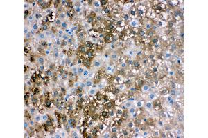 Anti-liver FABP antibody,  IHC(P) IHC(P): Rat Liver Tissue (FABP1 抗体  (N-Term))