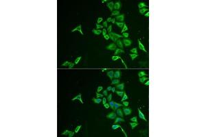 Immunofluorescence analysis of U2OS cells using INPP5J antibody (ABIN6132490, ABIN6142471, ABIN6142472 and ABIN6222324). (INPP5J 抗体  (AA 60-360))