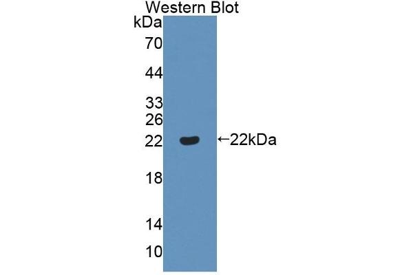 ADAMTS13 anticorps  (AA 896-1131)
