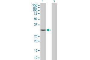 Western Blot analysis of TBCB expression in transfected 293T cell line by TBCB MaxPab polyclonal antibody. (TBCB 抗体  (AA 1-244))