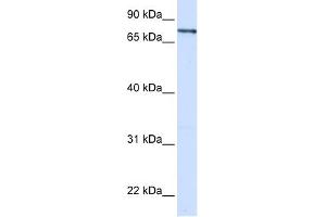 WB Suggested Anti-ZNF180 Antibody Titration:  0. (ZNF180 抗体  (Middle Region))