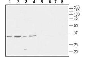 Western Blotting (WB) image for anti-Calcium Channel, Voltage-Dependent, gamma Subunit 4 (CACNG4) (AA 208-220), (Intracellular) antibody (ABIN7042992)