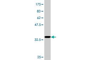 Western Blot detection against Immunogen (36. (RPRD1A 抗体  (AA 76-170))