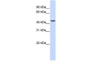 WB Suggested Anti-ELAC1 Antibody Titration:  0. (ELAC1 抗体  (Middle Region))