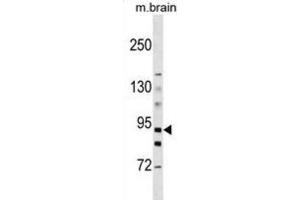 Western Blotting (WB) image for anti-Hexokinase 3 (White Cell) (HK3) antibody (ABIN3003707) (HK3 抗体)