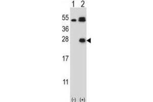Western Blotting (WB) image for anti-Kallikrein 6 (KLK6) antibody (ABIN5022442) (Kallikrein 6 抗体)