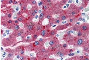 Human Liver (formalin-fixed, paraffin-embedded) stained with CFH antibody ABIN364283 at 20 ug/ml followed by biotinylated anti-mouse IgG secondary antibody ABIN481714, alkaline phosphatase-streptavidin and chromogen. (Complement Factor H 抗体)