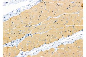 ABIN6265412 and ABIN6279864 at 1/100 staining Rat skin tissue by IHC-P. (SYT10 抗体  (C-Term))